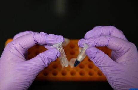 重大突破！我國科學(xué)家首次實(shí)現(xiàn)用二氧化碳人工合成淀粉