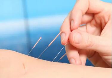 張伯禮、劉保延談針灸治療納入最新“新冠診療方案”