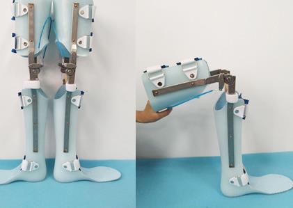 規(guī)范踝足矯形器應用 腦卒中康復有了“國家標準”