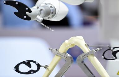 “達芬奇手術(shù)機器人”等76個新項目納入醫(yī)保