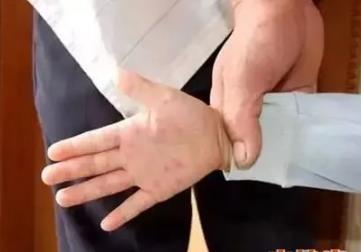 多省預(yù)警手足口病來襲！4種情況及時就醫(yī)