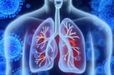 冬季急性呼吸道感染病例增加世衛(wèi)組織認(rèn)為“趨勢(shì)未超預(yù)期”