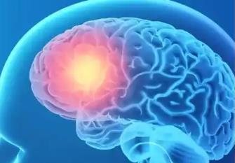 大規(guī)模臨床試驗(yàn)證實(shí)：低風(fēng)險(xiǎn)卒中患者監(jiān)測(cè)頻率可減半至17次