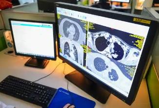 先行先試！5省份醫(yī)保影像云索引數(shù)據(jù)歸集364萬(wàn)條