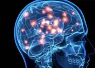 腦內(nèi)藥物遞送技術(shù)研發(fā)進(jìn)入快車道