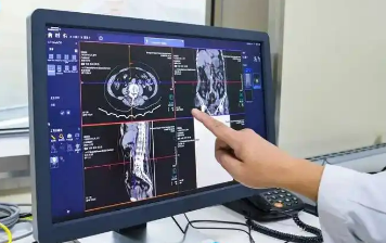 醫(yī)保影像實現(xiàn)跨省調(diào)閱 讓優(yōu)質(zhì)醫(yī)療資源惠及更多百姓