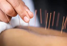 中醫(yī)藥在海外“出圈”了