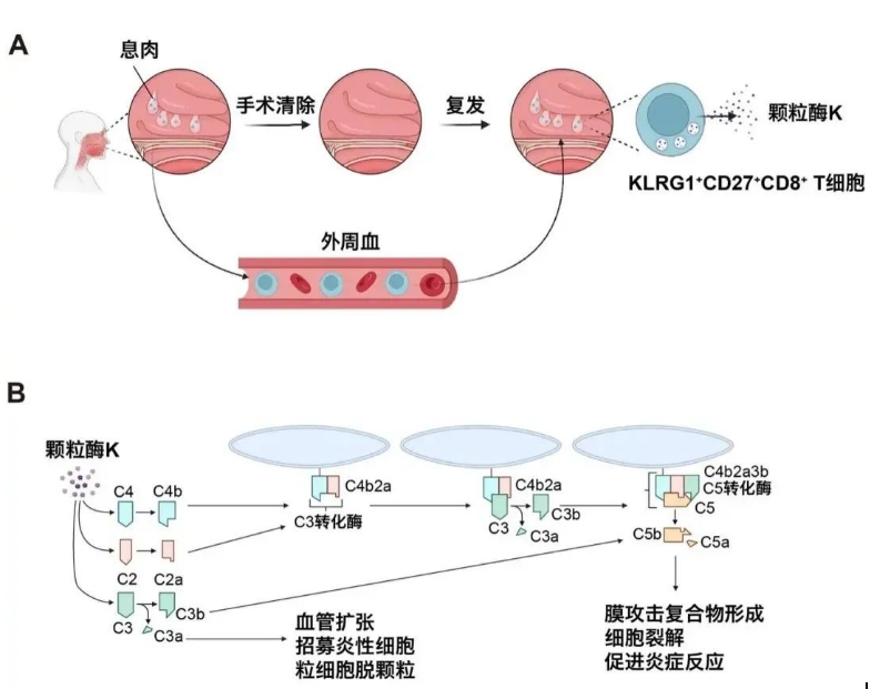 清華大學(xué)與北京同仁醫(yī)院團(tuán)隊(duì)發(fā)表研究 揭示慢性鼻病復(fù)發(fā)關(guān)鍵機(jī)制